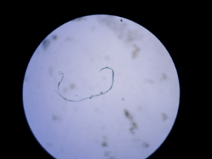 Fibra de Microplásticos extraída del estómago de una pinchagua por los investigadores Blgos. Daniel Laaz y Mercy Preciado del Instituto Nacional de Pesca.
